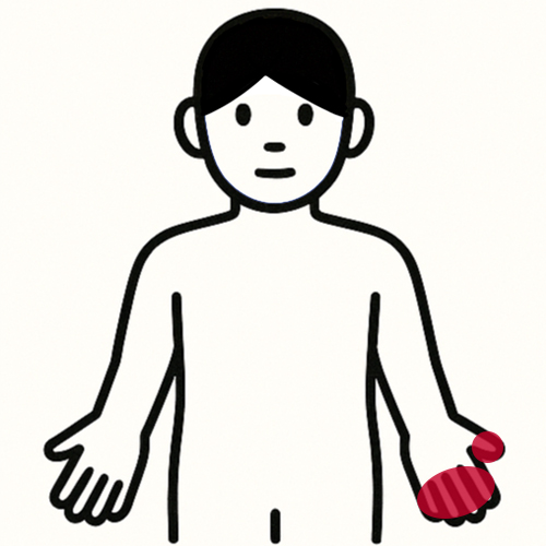 腕・手の痛い場所