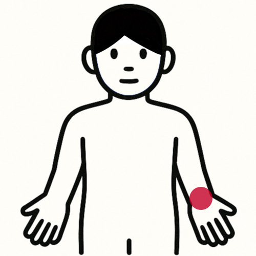 腕・手の痛い場所