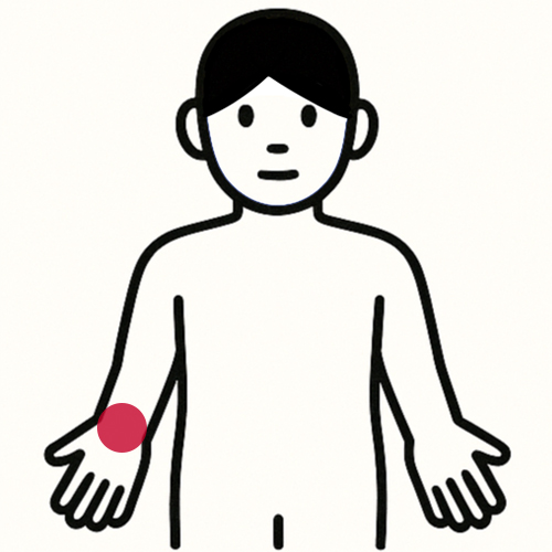 腕・手の痛い場所